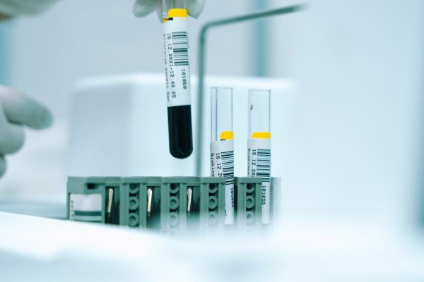 ВІЛ: ранні симптоми, період без проявів і точність тестування