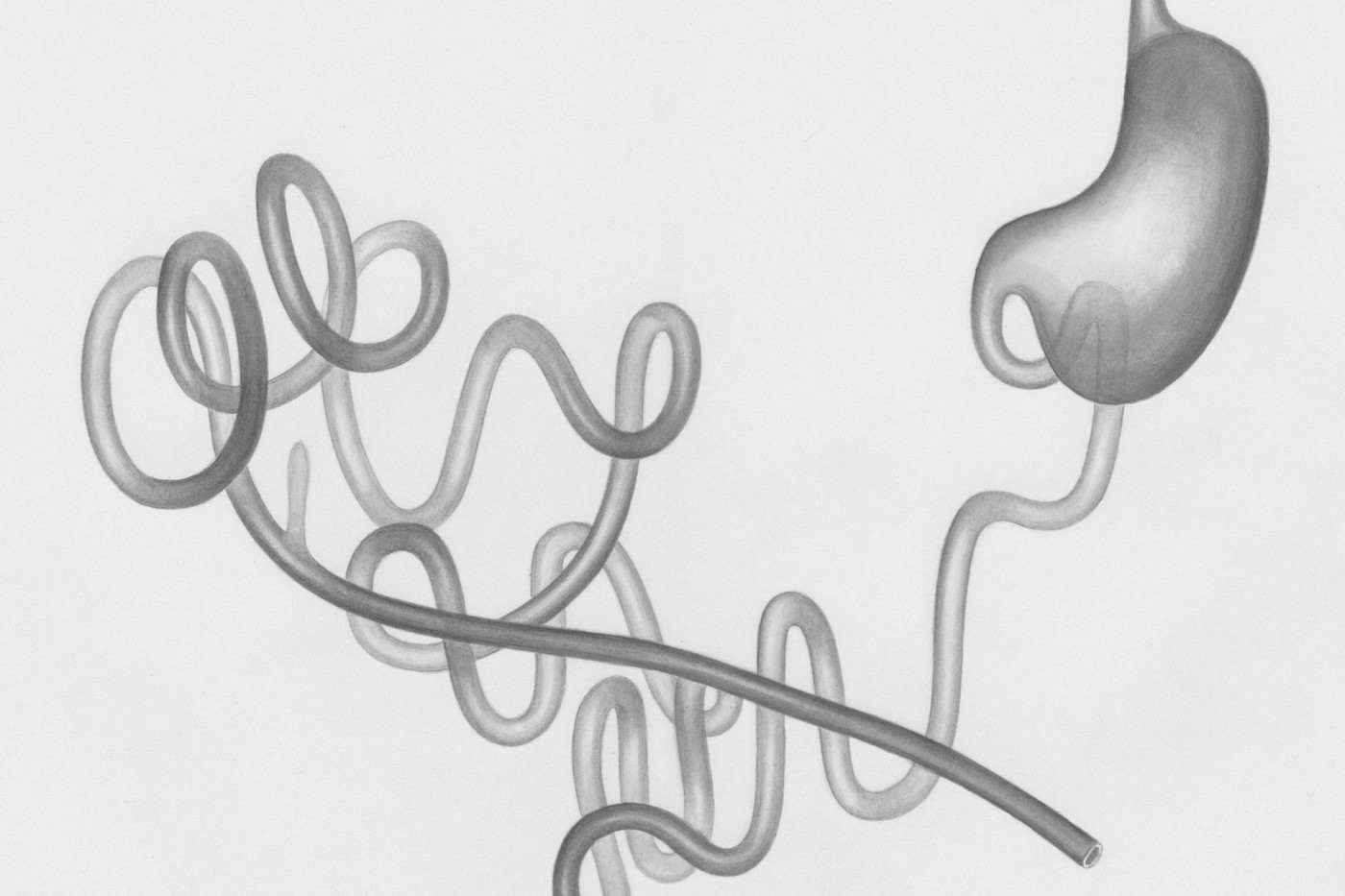 Helicobacter pylori: симптоми, тести та контроль після ерадикації